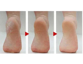 Picior pedichiura Fișier Callus Remover Picior din Oțel Inoxidabil Racleta Portabil Rasp Colosale Picior Răzătoare Scruber Pentru Picioare#y3